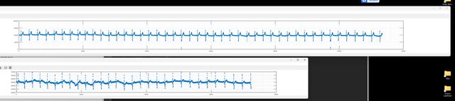 Heartly development photograph — Heartly_2Leads.png